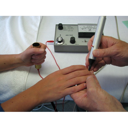 Electro acupunctuur